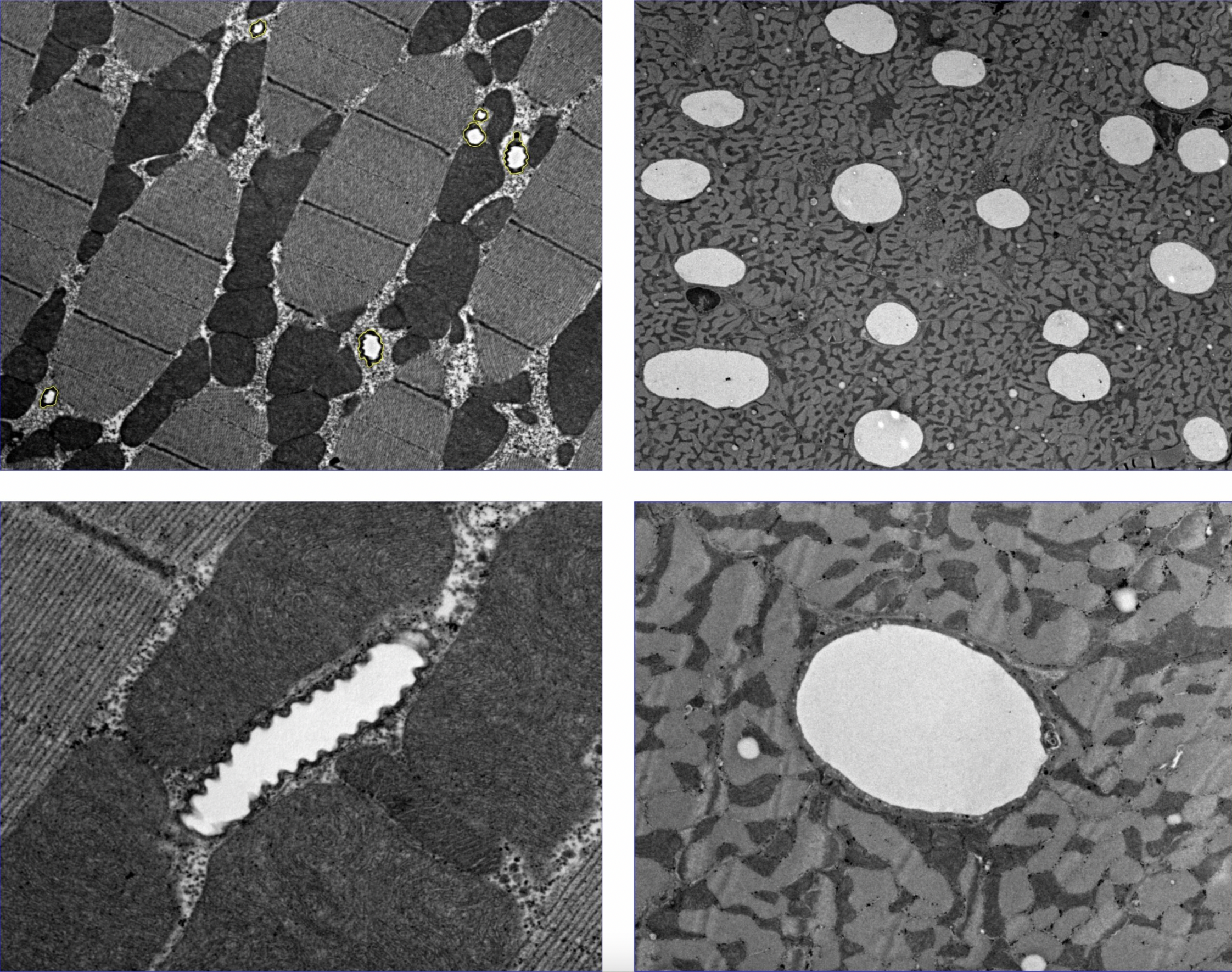 Insect flight muscle (left) compared against mammalian cardiac tissue (right), contrasting the different size and space needed to accommodate the oxygen-supply structures of insects (tracheoles) versus mammals (capillaries)) Insect flight muscle (left) compared against mammalian cardiac tissue (right), contrasting the different size and space needed to accommodate the oxygen-supply structures of insects (tracheoles) versus mammals (capillaries))